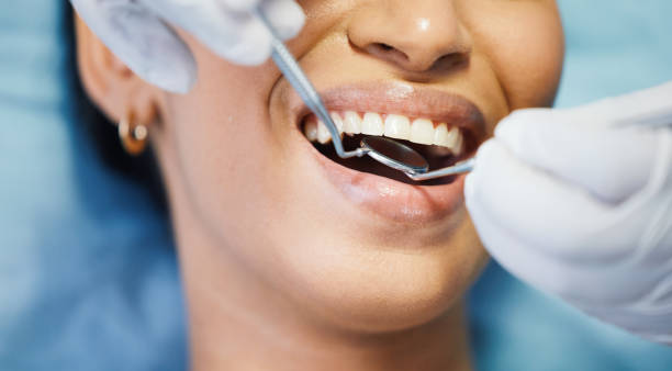 Best Emergency Dental Extractions in Newark, TX